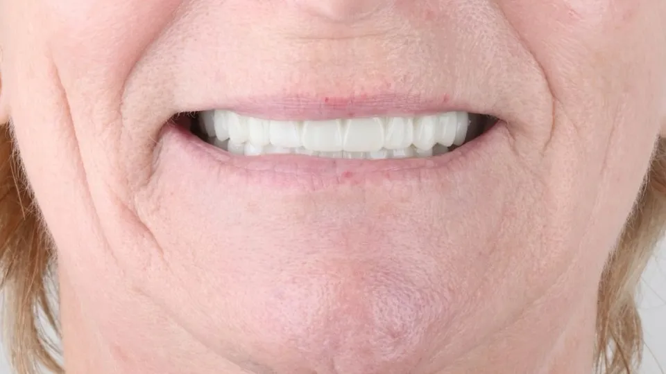 Le sourire d'une patiente après un traitement chez Phinova Clinics
